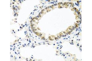 Immunohistochemistry of paraffin-embedded Rat lung using BMP5 Polyclonal Antibody at dilution of 1:100 (40x lens).