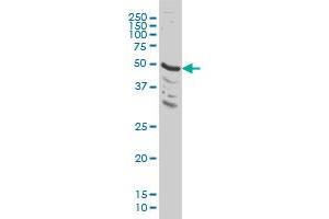 MAPK9 monoclonal antibody (M03), clone 3C12 Western Blot analysis of MAPK9 expression in HeLa .