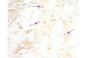 Rat brain tissue was stained by Rabbit Anti-Neuromedin S Prepro (70-103) (Mouse) Serum (NMS anticorps  (Preproprotein))