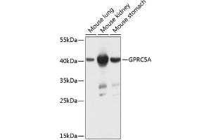 Western blot analysis of extracts of various cell lines, using GPRC5A antibody (ABIN6131897, ABIN6141357, ABIN6141358 and ABIN6224198) at 1:1000 dilution.