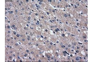 Immunohistochemical staining of paraffin-embedded liver tissue using anti-SLC2A5mouse monoclonal antibody. (SLC2A5 anticorps)