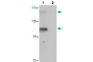 Western blot analysis of RUSC2 in SK-N-SH cell lysate with RUSC2 polyclonal antibody  at 1 ug/mL in (lane 1) the absence and (lane 2) the presence of blocking peptide. (RUSC2 anticorps  (N-Term))