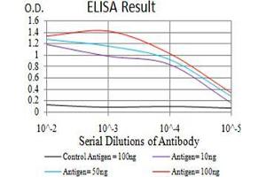 Black line: Control Antigen (100 ng);Purple line: Antigen (10ng); Blue line: Antigen (50 ng); Red line:Antigen (100 ng)