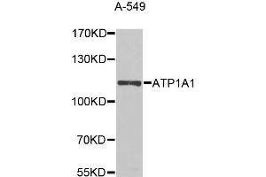Western blot analysis of extracts of A-549 cells, using ATP1A1 antibody (ABIN5995394) at 1/1000 dilution. (ATP1A1 anticorps)