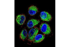 Confocal immunofluorescent analysis of TBC1D13 Antibody (Center) (ABIN655819 and ABIN2845243) with NCI- cell followed by Alexa Fluor 488-conjugated goat anti-rabbit lgG (green).