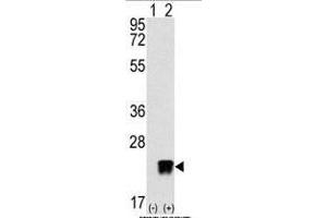 Western blot analysis of ARL3 (arrow) using rabbit polyclonal ARL3 Antibody (C-term) (ABIN389001 and ABIN2839231).