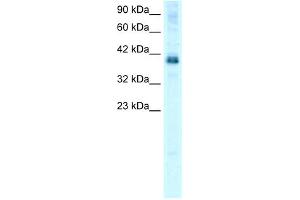 WB Suggested Anti-TSC22D4 Antibody Titration: 0. (TSC22D4 anticorps  (N-Term))