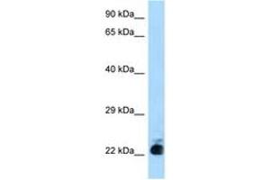 Image no. 1 for anti-Solute Carrier Family 31 (Copper Transporters), Member 1 (SLC31A1) (N-Term) antibody (ABIN6748037) (SLC31A1 anticorps  (N-Term))