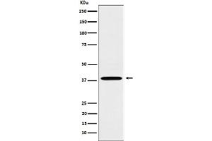 Western blot analysis of LTB4R expression in A549 cell lysate.
