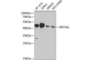 Western blot analysis of extracts of various cell lines using RPH3AL Polyclonal Antibody at dilution of 1:1000. (RPH3AL anticorps)