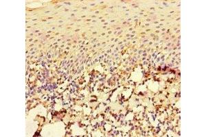 Immunohistochemistry of paraffin-embedded human tonsil tissue using ABIN7167196 at dilution of 1:100 (RAC1 anticorps  (AA 11-185))