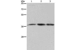 Western Blot analysis of 293T and LoVo cell, Human brain malignant glioma tissue using CAB39 Polyclonal Antibody at dilution of 1:450 (CAB39 anticorps)