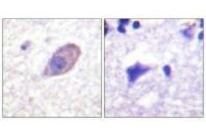Immunohistochemistry analysis of paraffin-embedded human brain tissue using Kir5.