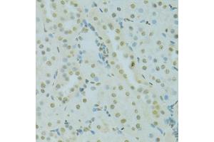 Immunohistochemistry of paraffin-embedded rat kidney using SAFB antibody (ABIN5975793) at dilution of 1/100 (40x lens). (SAFB anticorps)