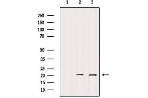 Western blot analysis of extracts from various samples, using IMMP2L Antibody.