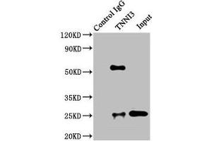 Immunoprecipitating TNNI3 in Rat heart tissue Lane 1: Rabbit control IgG instead of ABIN7173574 in Rat heart tissue. (TNNI3 anticorps  (AA 2-210))