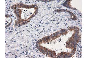 Image no. 14 for anti-Glucosidase, Beta, Acid 3 (Cytosolic) (GBA3) (AA 1-150), (AA 370-469) antibody (ABIN1490582)