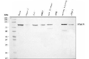 Western blot analysis of Semaphorin 3B/SEMA3B using anti-Semaphorin 3B/SEMA3B antibody (ABIN7602023).