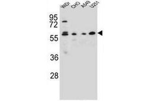 CEP70 Antibody (Center) western blot analysis in WiDr,CHO,A549,U251 cell line lysates (35µg/lane). (CEP70 anticorps  (Middle Region))