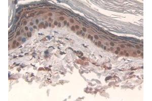 Detection of IL17RD in Rat Skin Tissue using Polyclonal Antibody to Interleukin 17 Receptor D (IL17RD) (IL17RD anticorps  (AA 356-605))