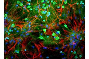 Rat mixed neuron/glial cultures stained with anti-UCHL1 antibody (green) and rabbit anti-GFAP antibody (620-GFAP) (red). (UCHL1 anticorps)
