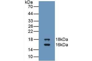 Detection of Recombinant GDF3, Human using Monoclonal Antibody to Growth Differentiation Factor 3 (GDF3) (GDF3 anticorps  (AA 251-364))