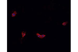 ABIN6269331 staining HeLa cells by IF/ICC.