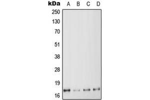Western blot analysis of MYL6 expression in HeLa (A), K562 (B), SP2/0 (C), H9C2 (D) whole cell lysates. (MYL6 anticorps  (Center))