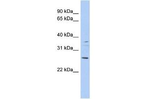 WB Suggested Anti-ASCL2 Antibody Titration:  0. (ASCL2 anticorps  (Middle Region))