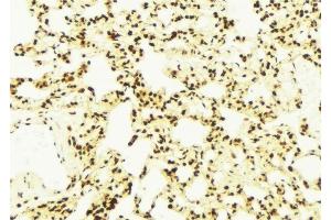 ABIN6278854 at 1/100 staining Mouse lung tissue by IHC-P.