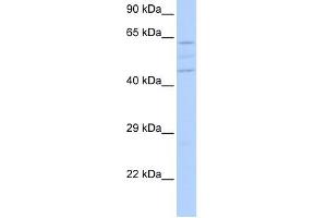 VPS37A antibody used at 1 ug/ml to detect target protein. (VPS37A anticorps)