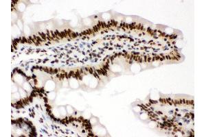Immunohistochemistry (Paraffin-embedded Sections) (IHC (p)) image for anti-Retinoblastoma Binding Protein 4 (RBBP4) (AA 395-425), (C-Term) antibody (ABIN3043920)