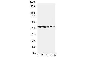 Western blot testing of Flotillin 1 antbody; Lane 1: rat lung;  2: (r) brain;  3: (r) ovary;  4: human SMMC-7721;  5: (h) MFC-7 cell lysate. (Flotillin 1 anticorps  (Middle Region))