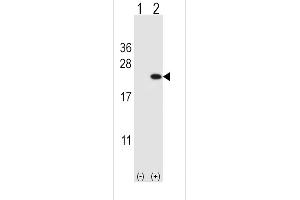 Western blot analysis of CFL1 (arrow) using rabbit polyclonal CFL1 Antibody (Center) (ABIN650759 and ABIN2839516).