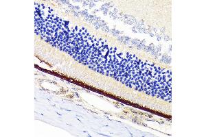 Immunohistochemistry of paraffin-embedded rat retina using RPE65 Rabbit mAb (ABIN7269933) at dilution of 1:100 (40x lens). (RPE65 anticorps)