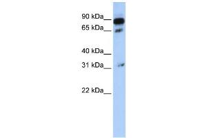 Western Blotting (WB) image for anti-ATP-Binding Cassette, Sub-Family D (Ald), Member 4 (ABCD4) antibody (ABIN2458768) (ABCD4 anticorps)