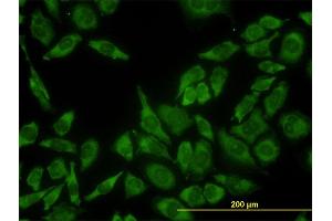 Immunofluorescence of monoclonal antibody to RPL13 on HeLa cell.