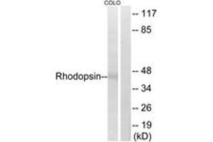 Western blot analysis of extracts from COLO cells, using Rhodopsin (Ab-334) Antibody. (Rhodopsin anticorps  (AA 299-348))