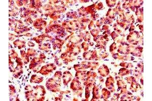 Immunohistochemistry of paraffin-embedded human pancreatic tissue using ABIN7161824 at dilution of 1:100 (NUP85 anticorps  (AA 201-500))
