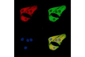 ABIN7096515 and ABIN7100579 staining Hela cells by IF/ICC. (SLC12A6 anticorps)