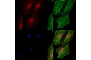 Phospho-SIRT2 (Ser368) Antibody staining A549 cells(heat shock treatment) by IF/ICC. (SIRT2 anticorps  (pSer368))