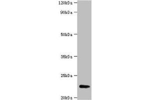 Western blot All lanes: FGF21 antibody at 2 μg/mL + A549 whole cell lysate Secondary Goat polyclonal to rabbit IgG at 1/15000 dilution Predicted band size: 23 kDa Observed band size: 23 kDa (FGF21 anticorps  (AA 29-209))