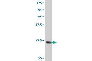 Western Blot detection against Immunogen (34.