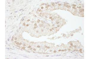 Immunohistochemistry (IHC) image for anti-Chromatin Assembly Factor 1, Subunit B (p60) (CHAF1B) (C-Term) antibody (ABIN7448454) (CHAF1B anticorps  (C-Term))