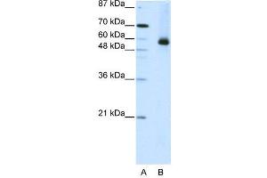 WB Suggested Anti-HNRPL  Antibody Titration: 2. (HNRNPL anticorps  (N-Term))