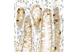 Immunohistochemistry of paraffin embedded human colon using CSF1 (ABIN7073553) at dilution of 1:900 (400x lens)
