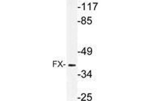 Western blot (WB) analysis of FX antibody in extracts from rat muscle cells. (TSTA3 anticorps)