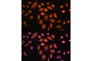 Immunofluorescence analysis of L929 cells using COPZ1 antibody (ABIN6127709, ABIN6138892, ABIN6138893 and ABIN6215734) at dilution of 1:100. (COPZ1 anticorps  (AA 1-177))