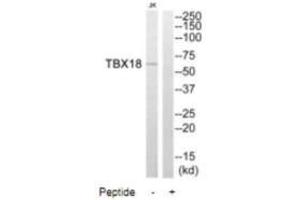 Western blot analysis of extracts from Jurkat cells, using TBX18 antibody. (T-Box 18 anticorps)