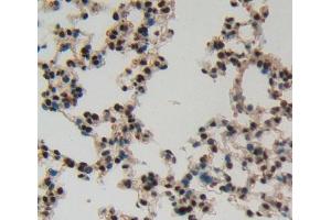 IHC-P analysis of Kidney tissue, with DAB staining. (IRF8 anticorps  (AA 1-327))